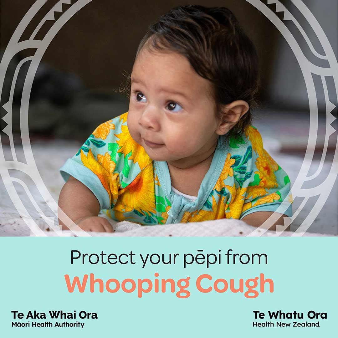 Whooping Cough Pepi